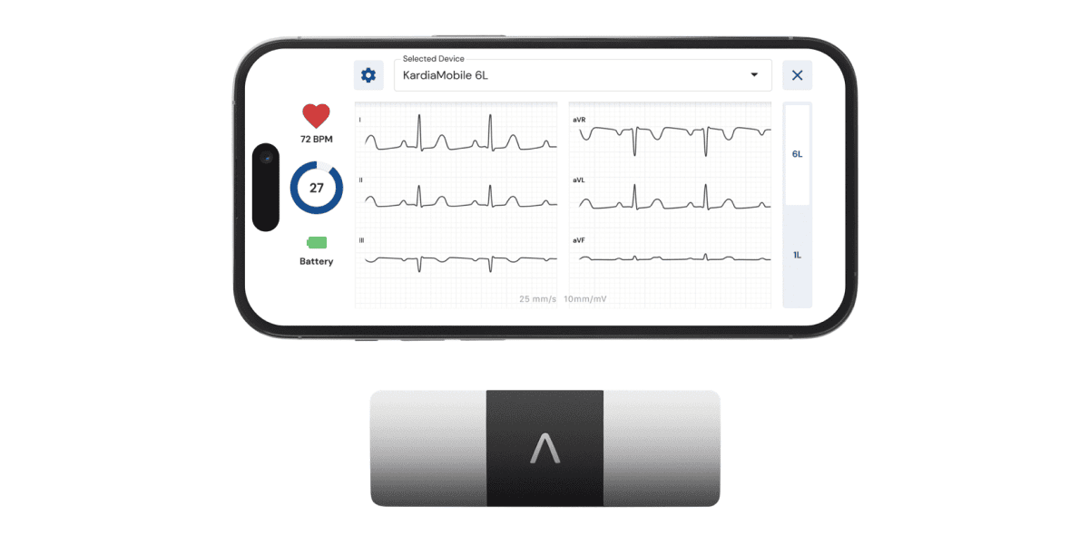 kardiamobile 6l six lead personal ekg